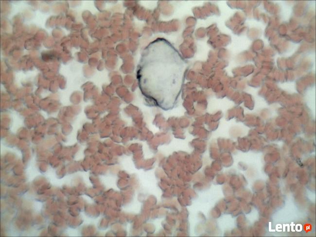 Analiza żywej kropli krwi Rzeszów