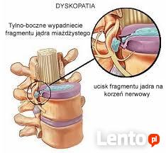 Fizjoterapia domowa, przyłóżkowa