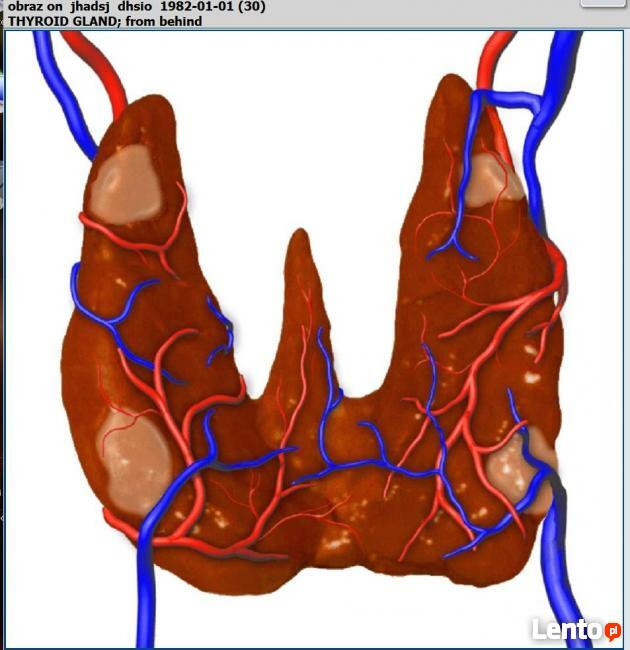 Metatron Hunter 4025 - system diagnostyki nieliniowej