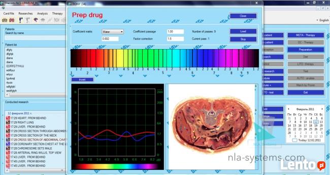 Diagnostyka NLS: Metatron, Diacom, 3D-NLS, inne - sprzedaż i