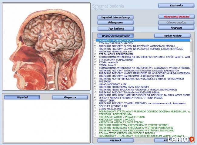 Sprzedam diagnostykę NLS metatron 4021 (oberon)