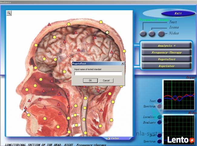 Diagnostyka NLS: Metatron, Diacom, 3D-NLS, inne - sprzedaż i