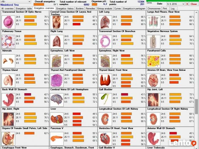 Diagnostyka NLS: Metatron, Diacom, 3D-NLS, inne - sprzedaż i