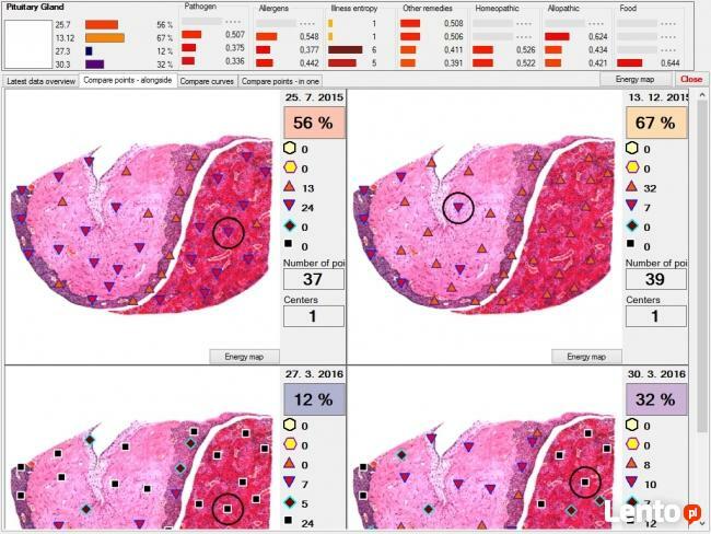 Szkolenie z zakresu NLS, Oprogramoiwanie, sprzedaż diagnosty