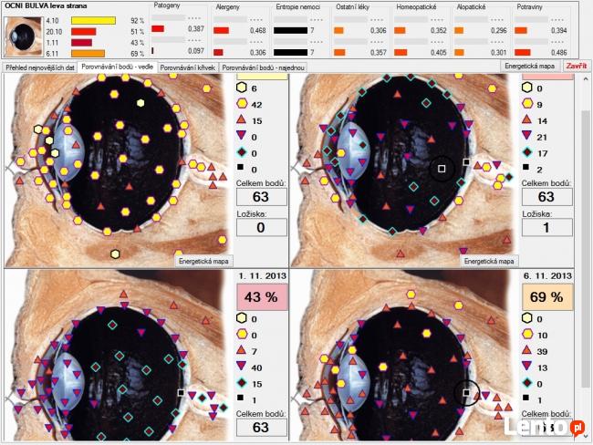 Diagnostyka NLS: Metatron, Diacom, 3D-NLS, inne - sprzedaż i