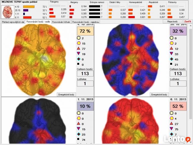 Diagnostyka NLS: Metatron, Diacom, 3D-NLS, inne - sprzedaż i