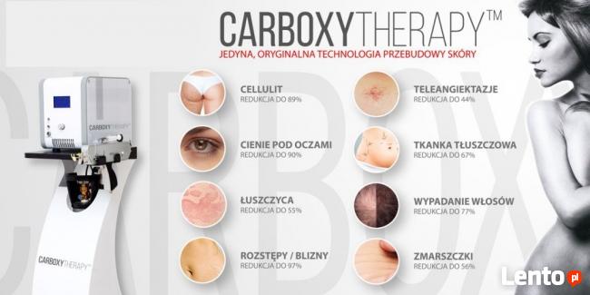Laserowa depilacja, usuwanie przebarwień, usuwanie tatuaży