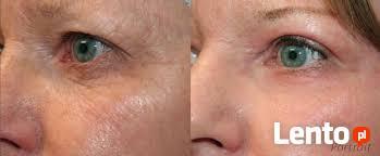 LAMPA LED PDT ŚWIATŁO-KOLORO-TERAPIA - NANO BIOMED I