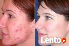 LAMPA LED PDT ŚWIATŁO-KOLORO-TERAPIA - NANO BIOMED I