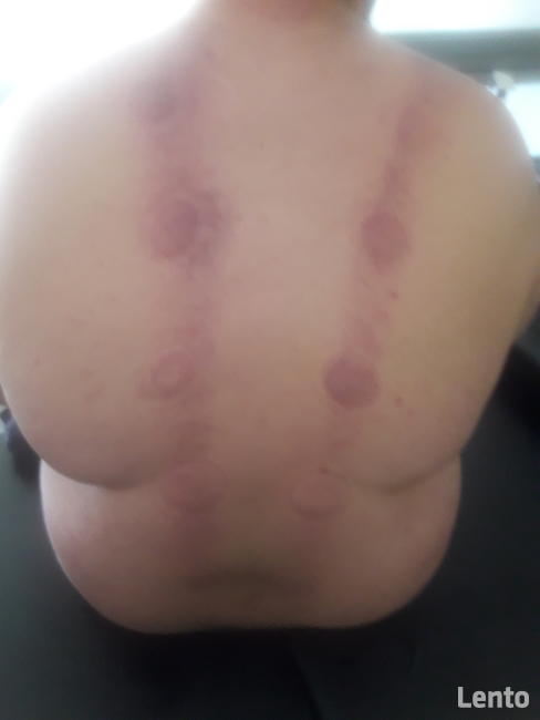 Profesjonalne masaże lecznicze