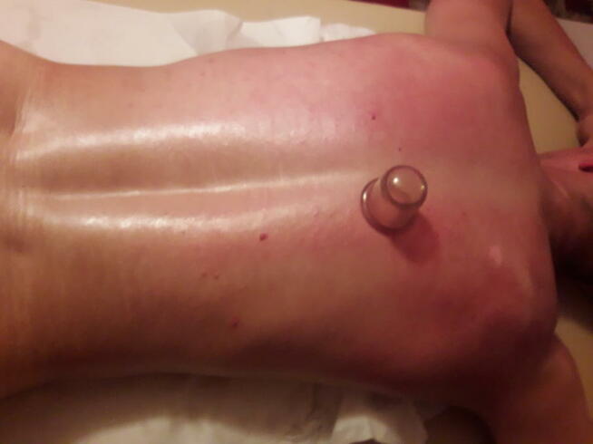 Profesjonalne masaże lecznicze