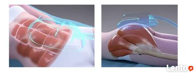 EMS stymulator mięśni, modelowanie ciała, szkolenie