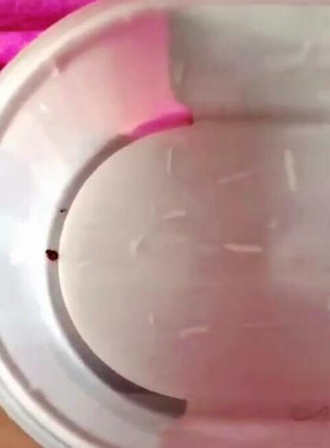 Pluskwa domowa, pluskwy, pozbądź się pluskwy, karaluchow