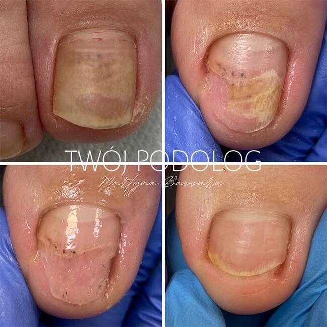 PODOLOG MOBILNY RZESZÓW I OKOLICE