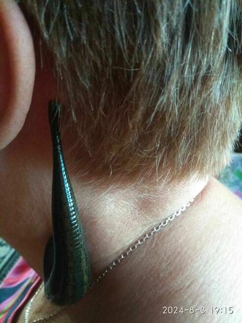 Pijawki lekarskie - Gabinet Hirudoterapii Lutomiersk