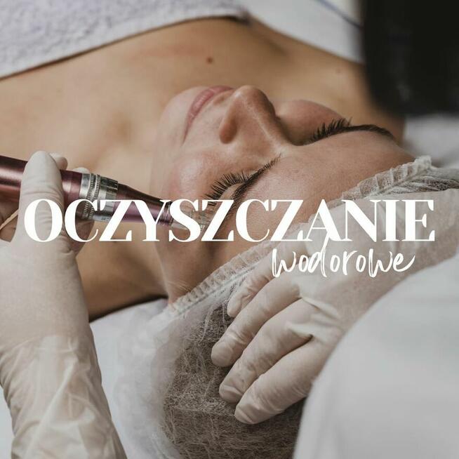 Modelowanie brzuszka . Przed i Po .