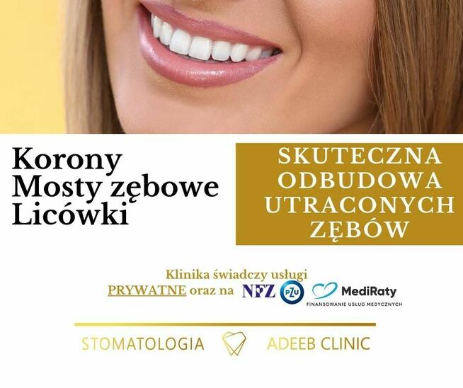 Bezpłatne usuwanie zębów i protezy w Dąbrowie Górniczej