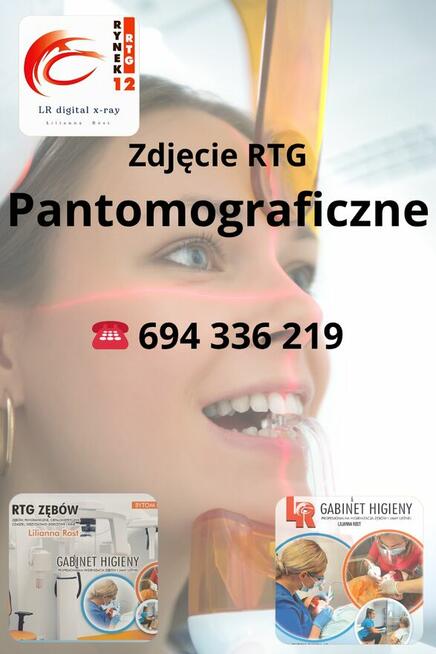 zdjęcie RTG Panoramiczne, pantomograficzne, Cefalometryczne