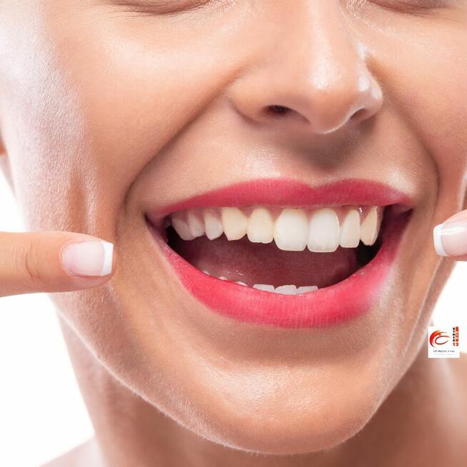 wybielanie zębów lampą, Stomatologia, stomatolog, dentysta,