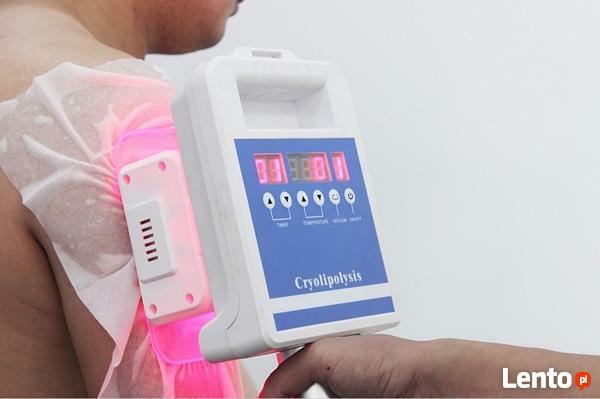 Kriolipoliza -chłodzenie tkanki tłuszczowej