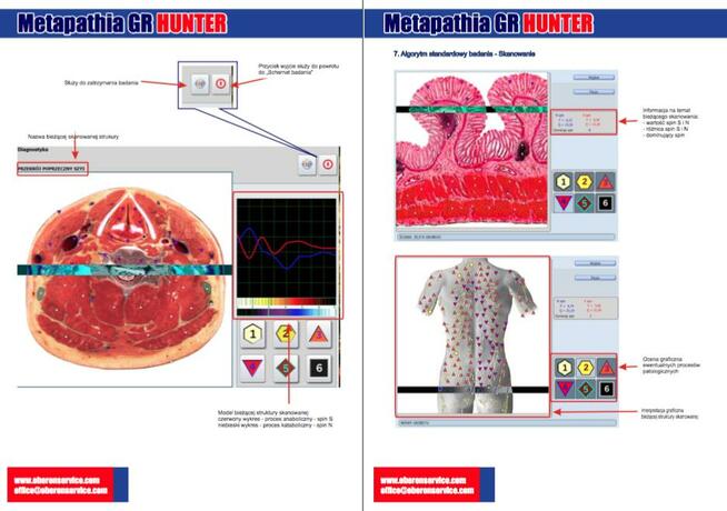 Profesjonalne szkolenia NLS Analiza, Metaterapia Biorezonans