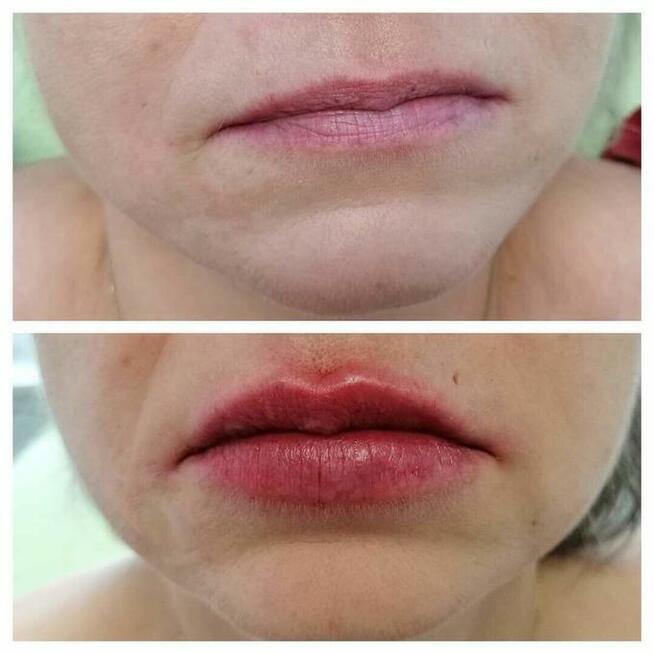 Rest Estemedica Gabinet kosmetologii i medycyny estetycznej