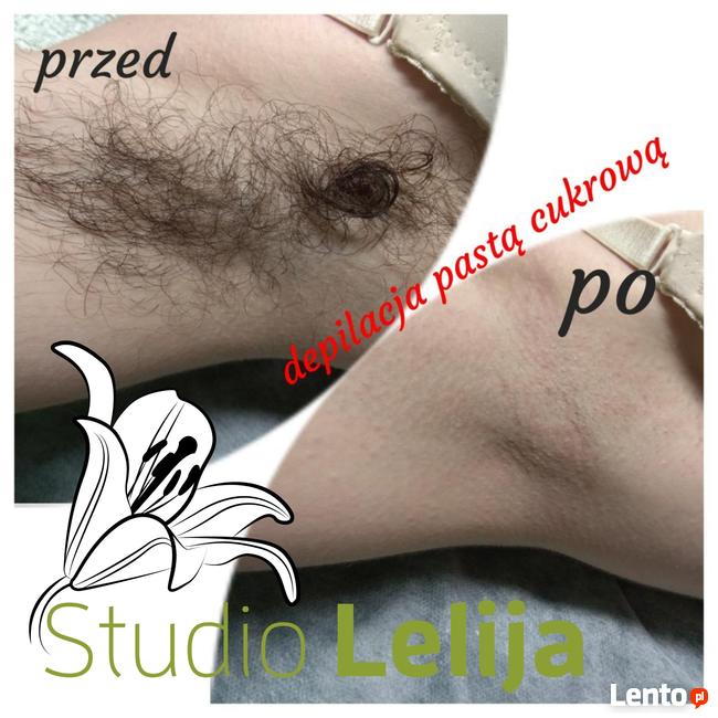 Depilacja całego ciała - damska i męska - pasta cukrowa