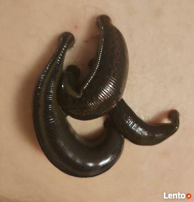 Hirudoterapia - leczenie pijawkami lekarskimi.