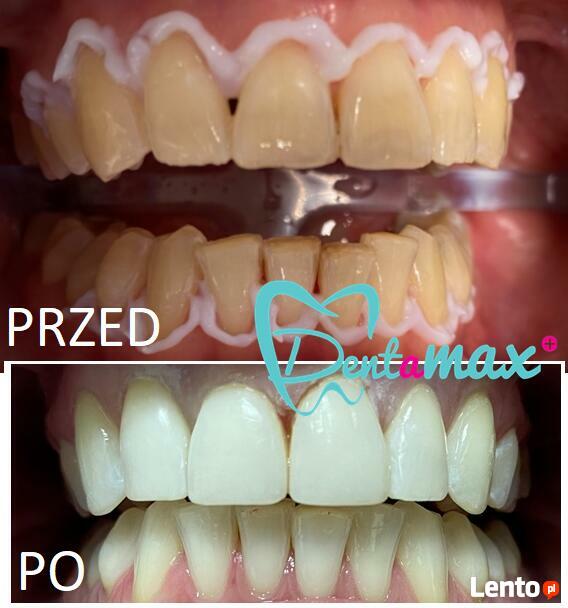 Bezpłatna konsultacja - Dentamax Nowosądecka 46 Kraków