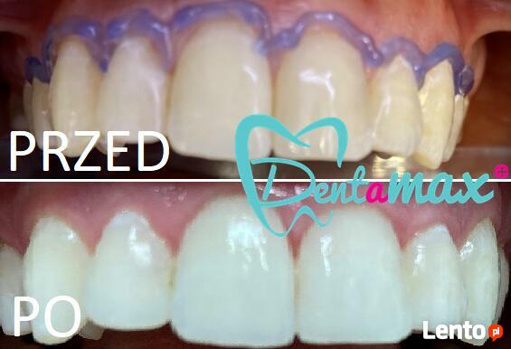 Bezpłatna konsultacja - Dentamax Nowosądecka 46 Kraków