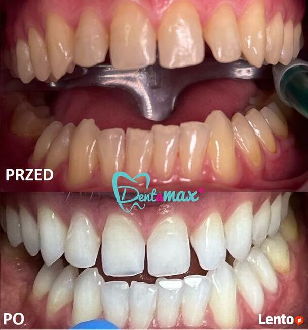 Bezpłatna konsultacja - Dentamax Nowosądecka 46 Kraków