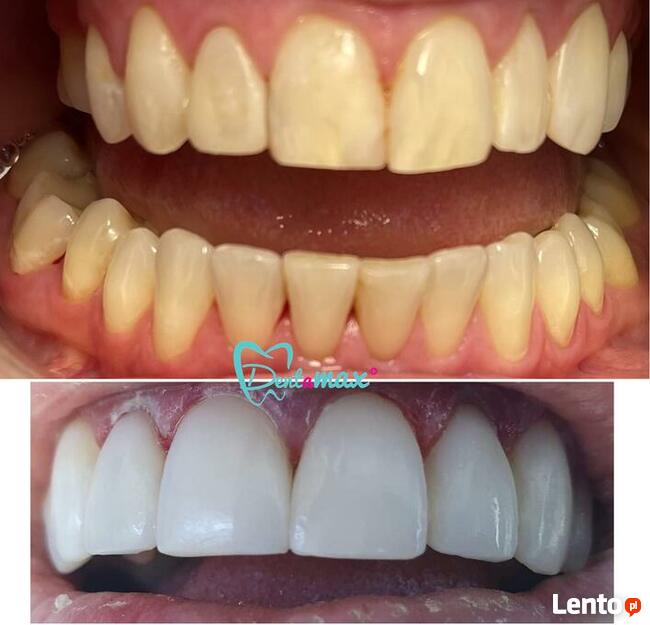 Bezpłatna konsultacja - Dentamax Nowosądecka 46 Kraków