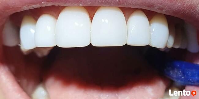 Bezpłatna konsultacja - Dentamax Nowosądecka 46 Kraków