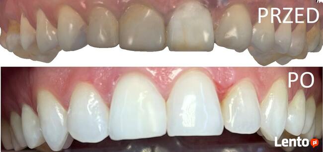 Bezpłatna konsultacja - Dentamax Nowosądecka 46 Kraków