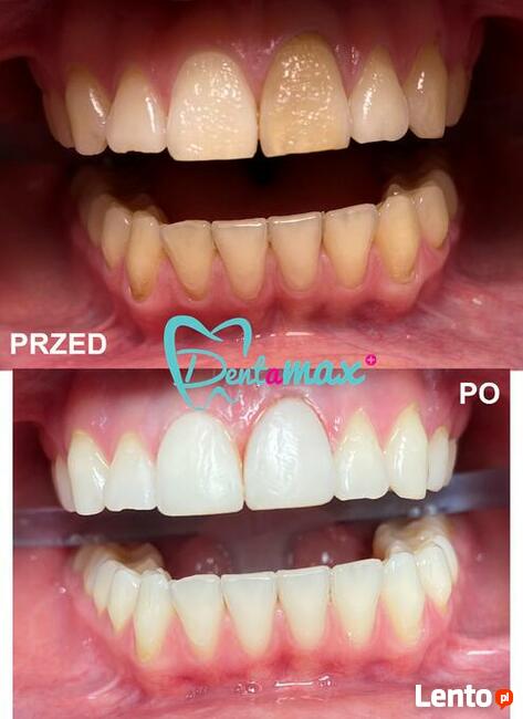 Bezpłatna konsultacja - Dentamax Nowosądecka 46 Kraków