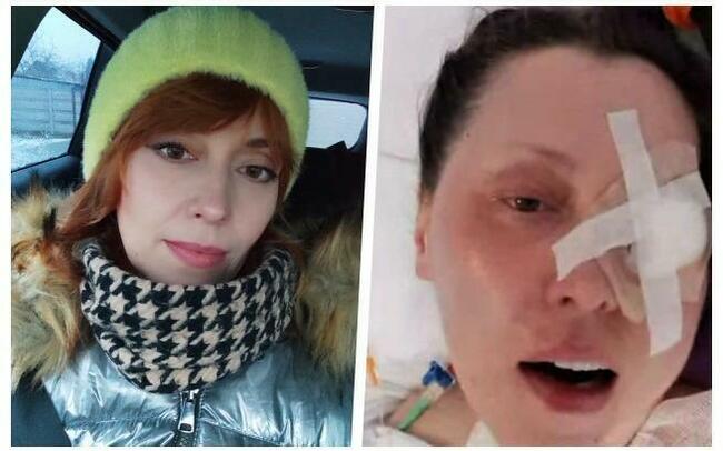 Pilne Błagam, pomóż Janie walczyć o sprawność.