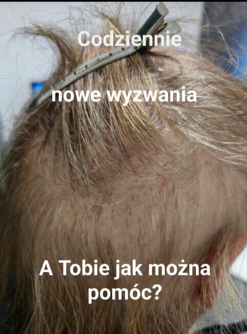 Trycholog Gdańsk - Gdańsk Przymorze