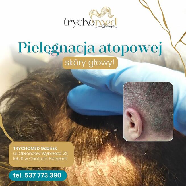 Trycholog Gdańsk - Gdańsk Przymorze