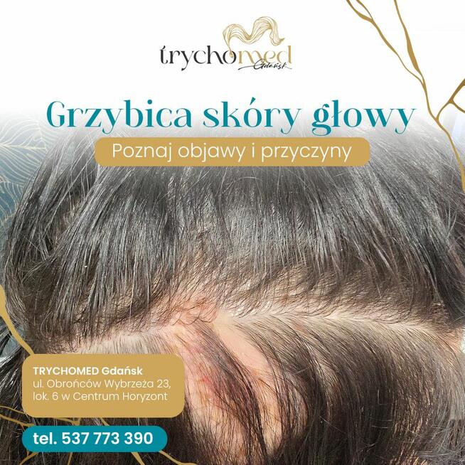 Trycholog Gdańsk - Gdańsk Przymorze