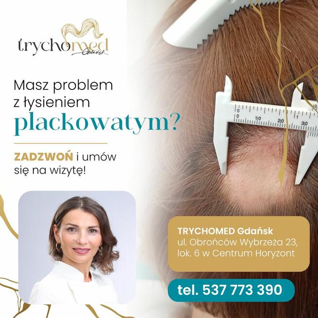 Trycholog Gdańsk - Gdańsk Przymorze