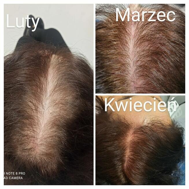 Trycholog Gdańsk - Gdańsk Przymorze