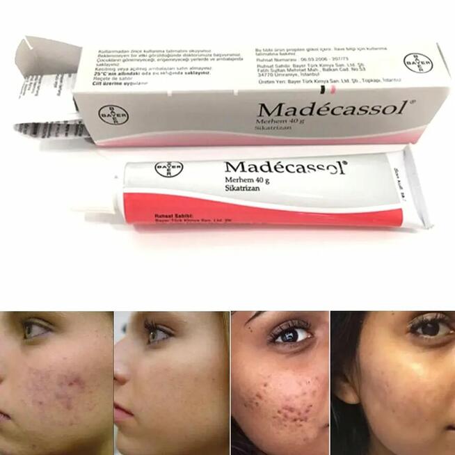 Madecassol 1% krem na blizny - Dostawa GRATIS