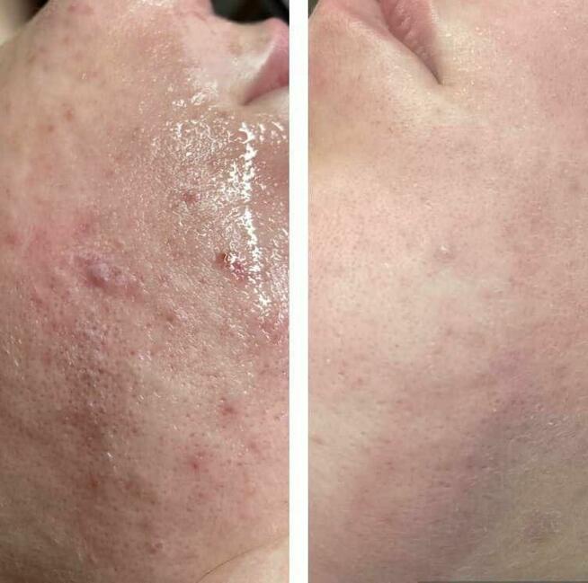 ZINTEGROWANY KURS KOSMETYCZNY I i II stopień