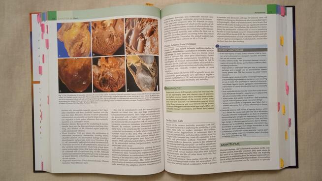 Robins Basic Pathology