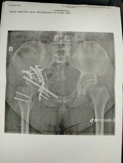 Proszę o pomoc w rehabilitacji