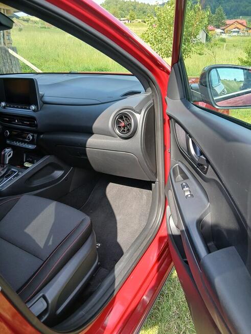 Hyundai Kona N line 1.6