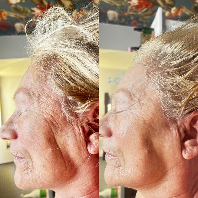 MASAŻ KOBIDO W OPOLU.150 zł!