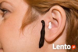 Leczenie Pijawkami Lekarskimi Bytom