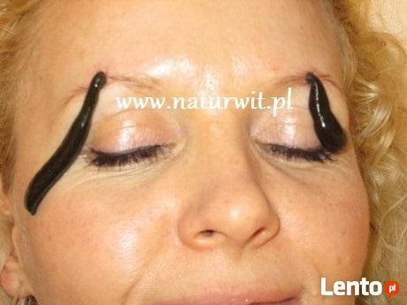 Leczenie Pijawkami Lekarskimi Bytom