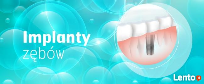 Dentysta Kraków - Dentamax Stomatologia Estetyczna